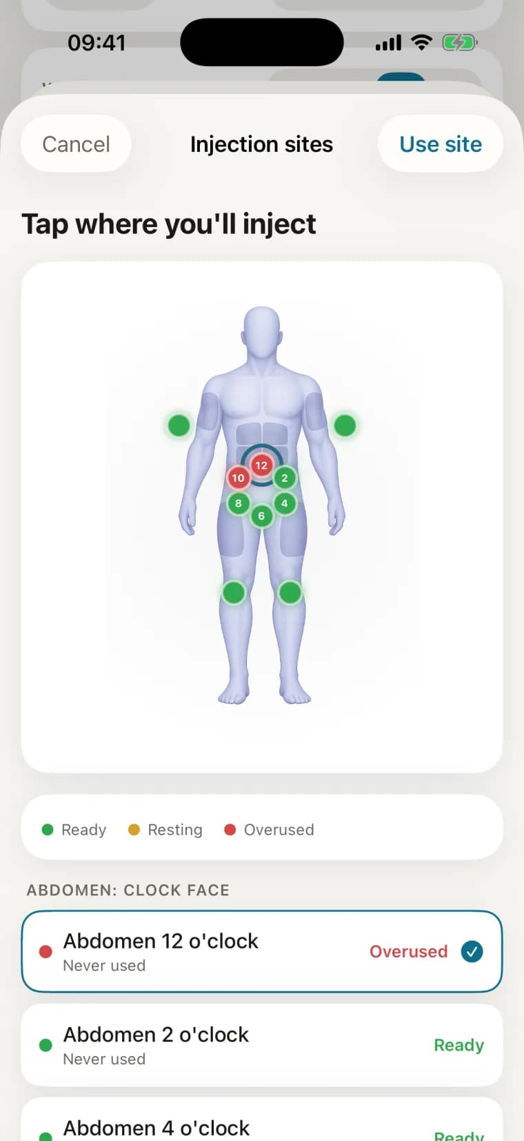Myo's Injection sites screen — a body map with ready, resting and overused site markers